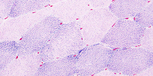 Microscopic visualization representing the digestive enzyme lipase with a purple and blue color scheme.