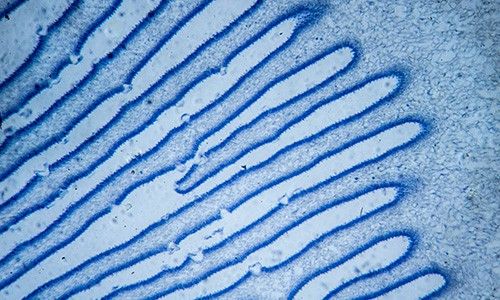 Microscopic visualization representing the digestive enzyme lipase with blue staining