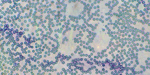 Microscopic visualization representing the digestive enzyme amylase with a blue and green color scheme.