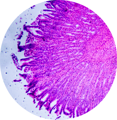 Microscopic slide with purple-stained intestinal tissue sample on a white background.