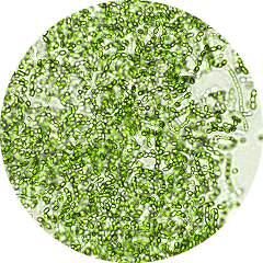 Microscopic view of densely clustered green microbial cells.