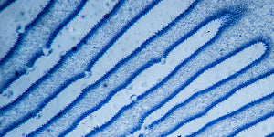 Microscopic visualization representing the digestive enzyme protease with blue staining.